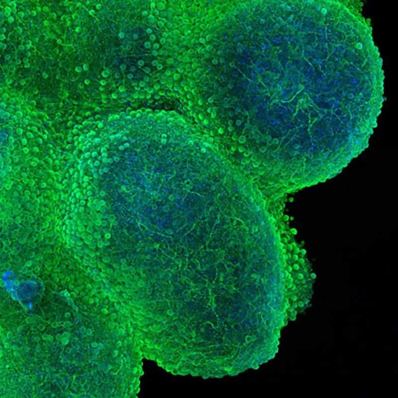 MAP2 (green) and Hoechst (blue) in a cortical organoid at DIV 45 with cell line KOLF2.1J. Sample courtesy of: Declan J. Brennan, Nygaard Lab at UBC.