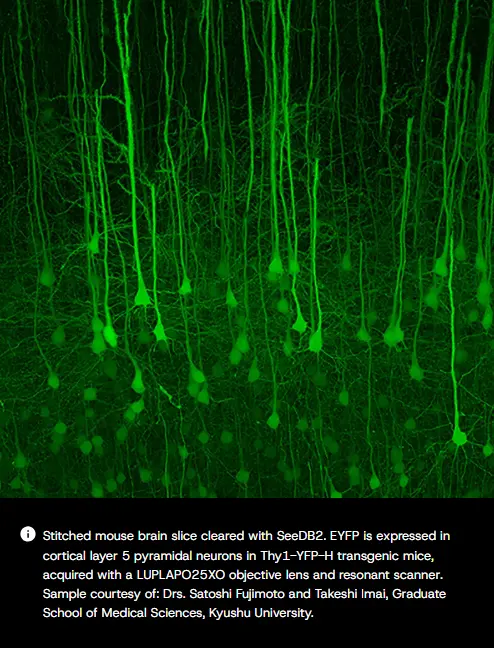 Fluorescent microscopy image of mouse brain slice showing green pyramidal neurons with long dendrites.