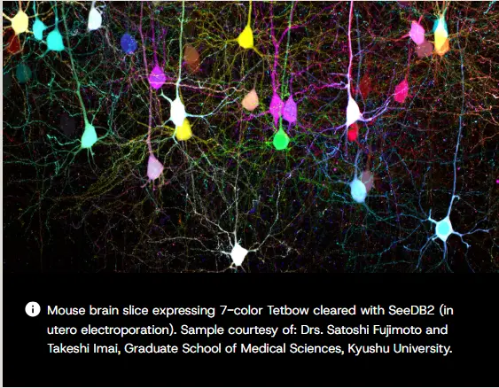 Mouse brain slice expressing 7-color Tetbow cleared with SeeDB2 (in utero electroporation)