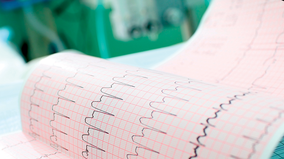 VAccine production monitoring Process Control & QC