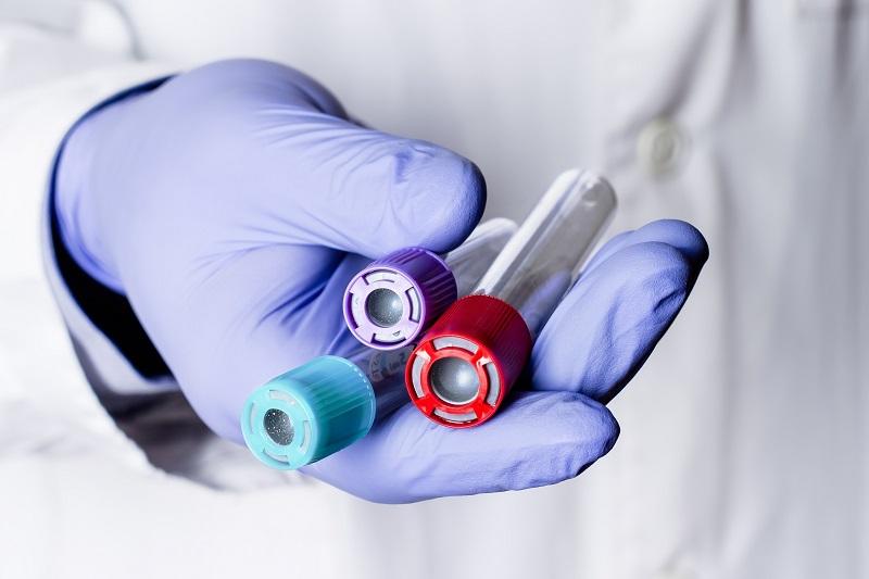 Échantillonnage clinique