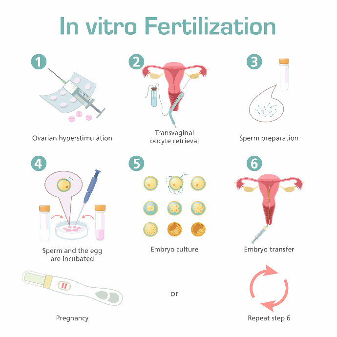 In-Vitro fertilization process procedure IVF