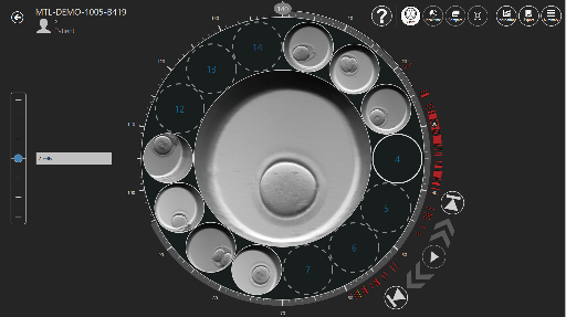 Software helpt bij het selecteren van het meest levensvatbare embryo IVF Time-lapse