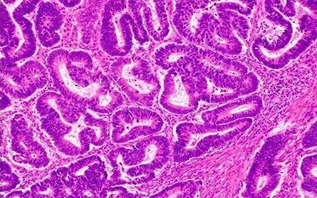 Evident microscopy Picture with Color Camera
