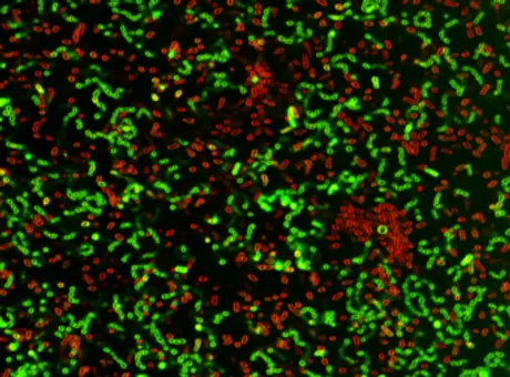 ACOERELA-Gram-typing of Bacteria
