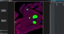 Evident TruAI Deep Learning - Pancreatic tissue analyzed with TruAI neural network segmentation for accurate islet detection