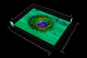 Advanced 3D Measurements of Laser Crater with Evident DSX2000 digital microscope
