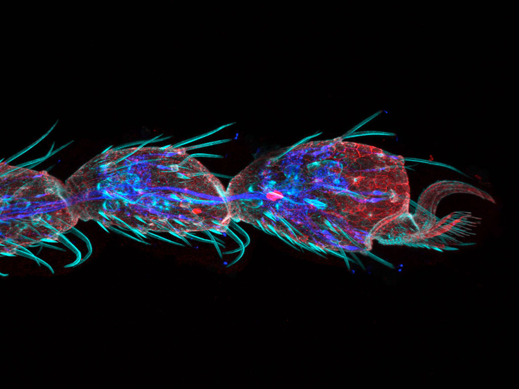 High-resolution Drosophila leg image captured with FV4000's TruSpectral technology, showcasing multiplexing capabilities
