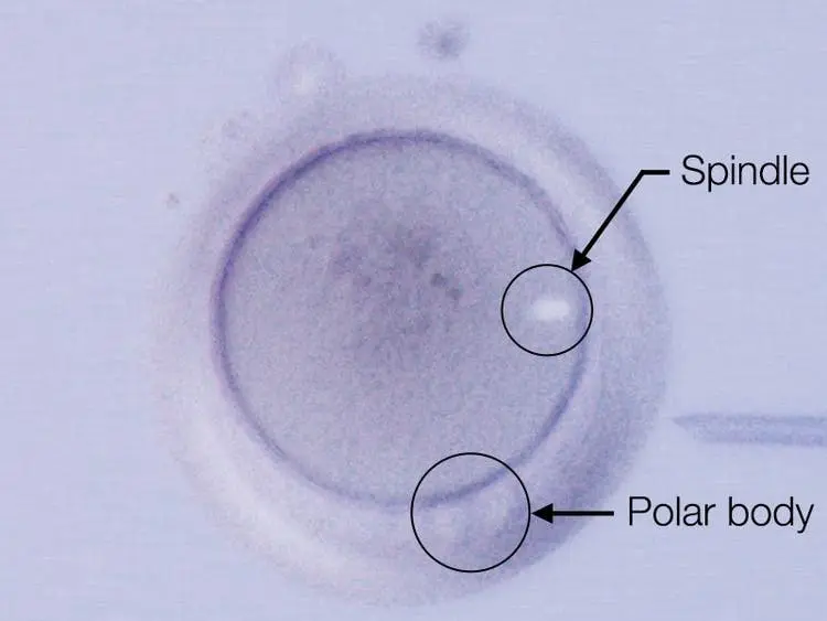 Spindle localization using polarized light in SL-ICSI
