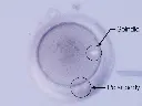 Spindle localization using polarized light in SL-ICSI