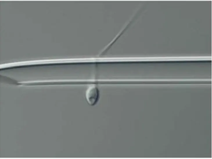 Differential interference contrast image for IMSI sperm selection