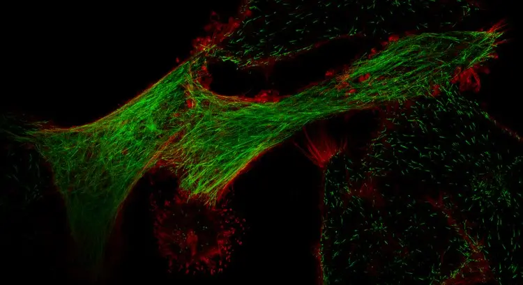 High-resolution HeLa super-resolution image (FV-OSR).webp