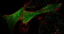 High-resolution HeLa super-resolution image (FV-OSR).webp