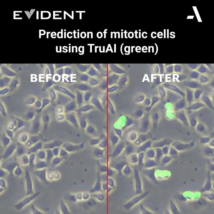 Evident-ScanR-High-end-microscope-Prediction-of-mitotic-cell-using-TruAI.webp