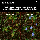 Evident-ScanR-High-end-microscope-prediction-glomeruli-positions-mouse-kidney-using-TruAI.webp