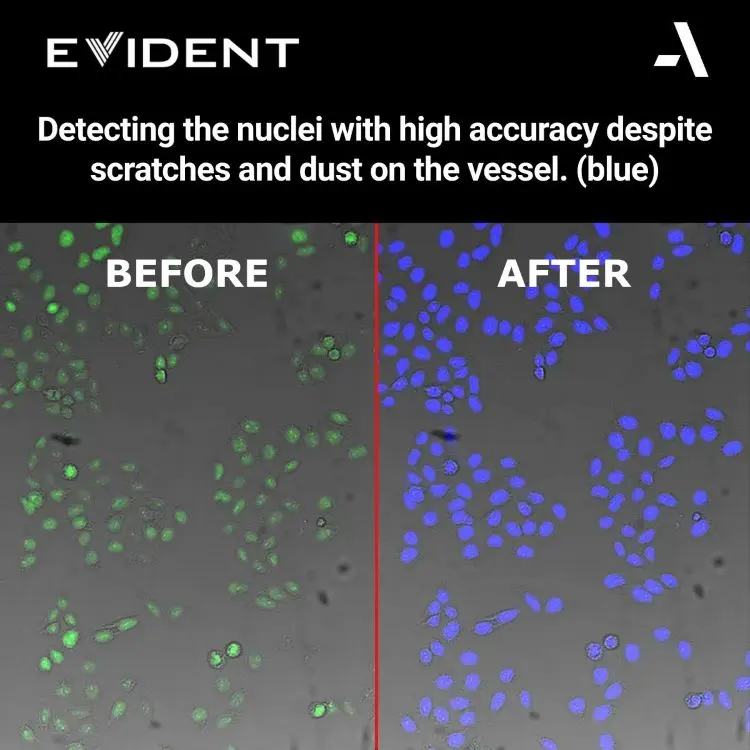 Evident-ScanR-High-end-microscope-High-accuracy-detection-of-nuclei.webp