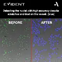 Evident-ScanR-High-end-microscope-High-accuracy-detection-of-nuclei.webp