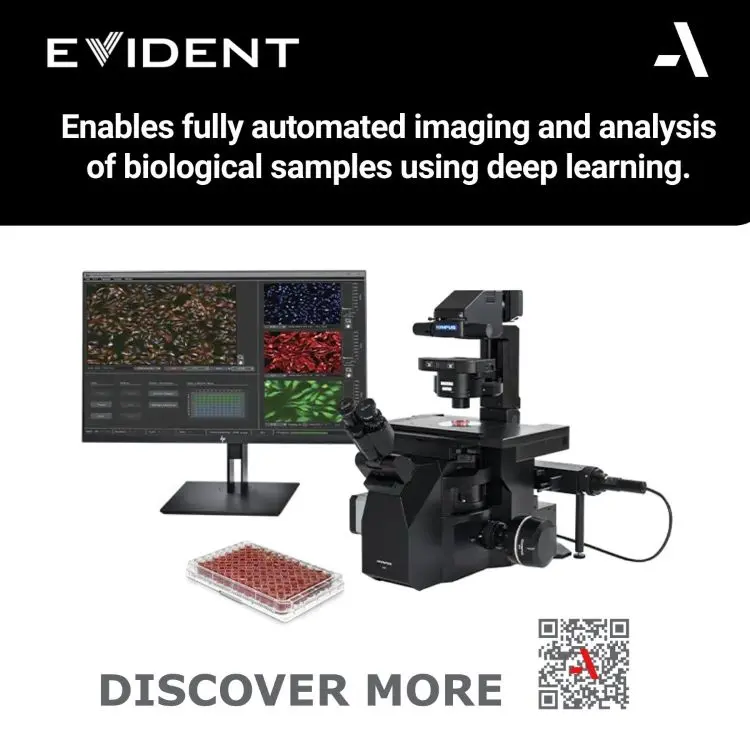 Evident-ScanR-High-end-microscope-with-fully-automated-imaging-analysis-using-deep-learning.webp