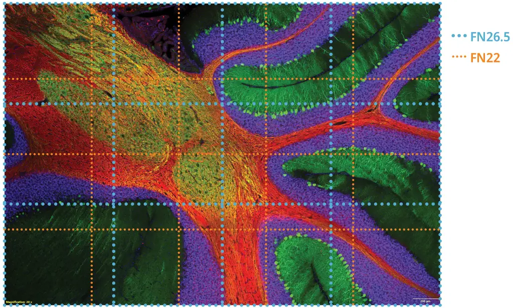 IX85-spin-xl-picture-Rat-cerebellum-Hoechst(blue)-Calbindin(green)-MAP2(orange)-MBP(red).webp