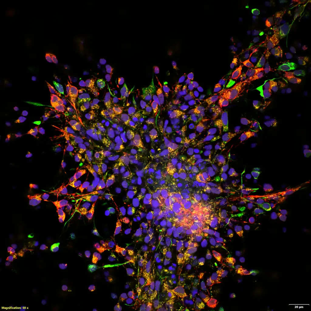 IX85-spin-xl-image-Neurons-DAPI (blue)-ATP5(yellow)-vimentin(red)-MAP2(green).webp