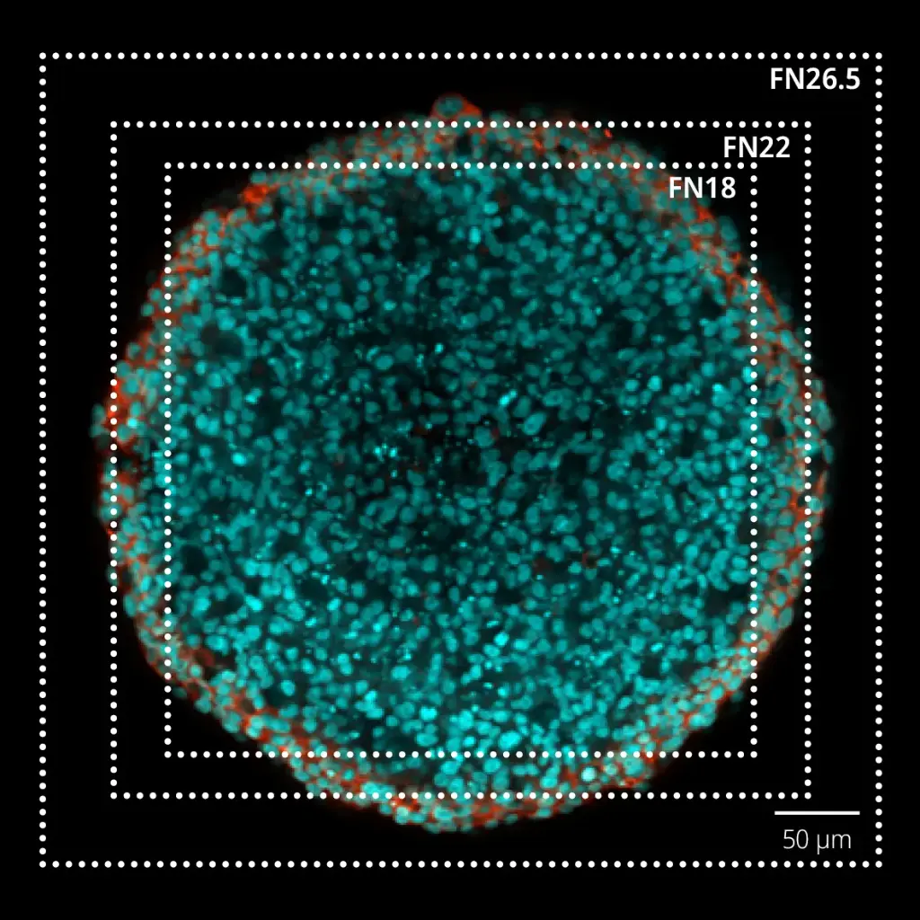IX85-spin-xl-picture-600µm-HT-29-spheroid-25Xobjective-DAPI(cyan)-phalloidin(red).webp