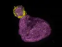 IX85-spin-xl-image-Organoid-Phalloidin(magenta)-E-cadherin(yellow).webp