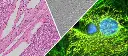 Evident-APX100-imaging-applications-for-slides-dishes-well-plates.webp
