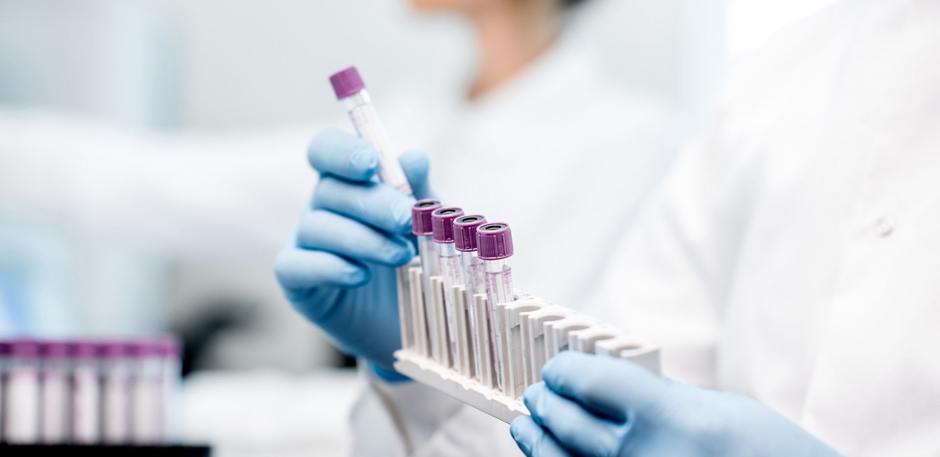 Manual Immunoassays
