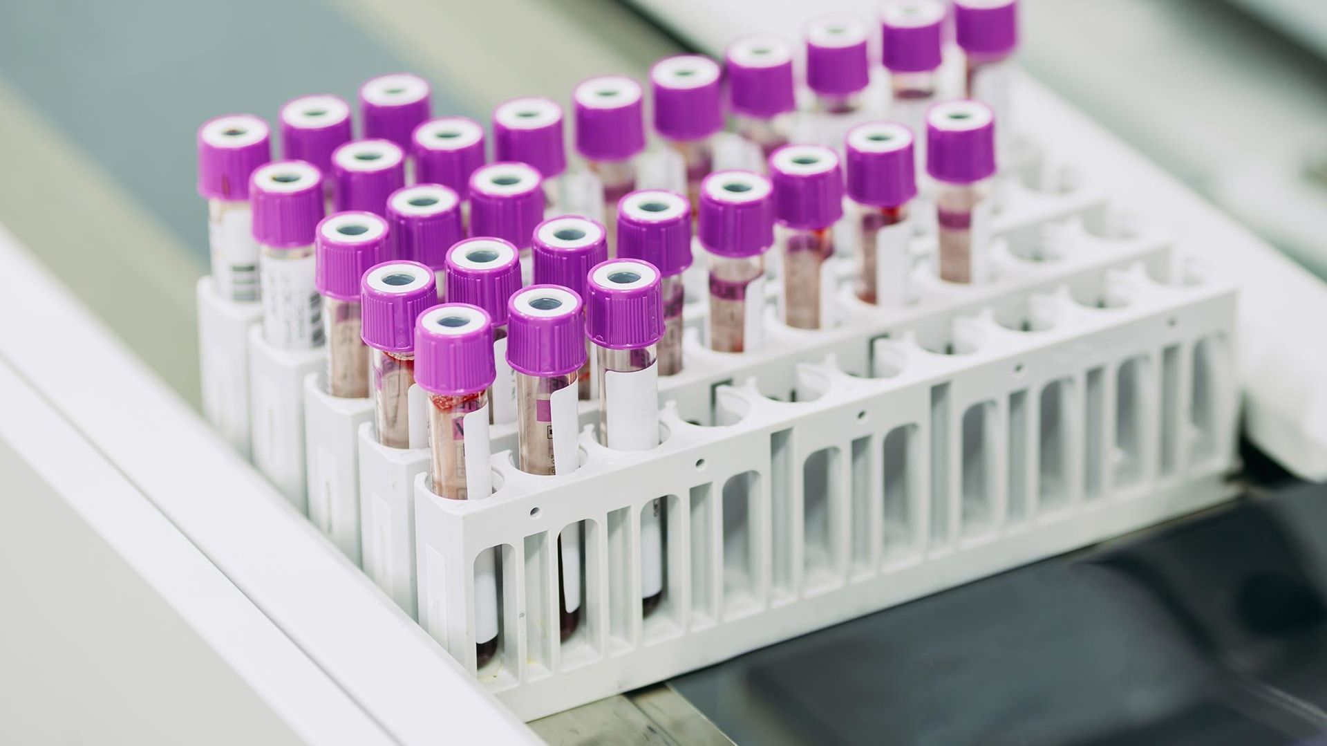 Automated centrifuges