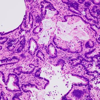 Microscopes for Clinical Diagnostics