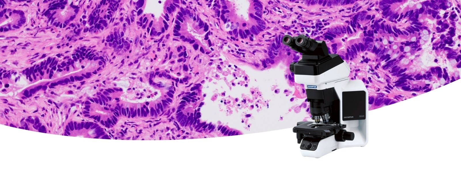 Upright Microscopes for Clinical Diagnostics